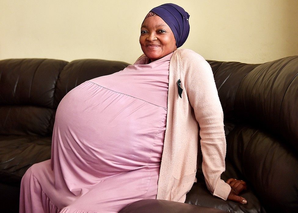 १० बच्चालाई जन्म दिँदै अफ्रिकी महिलाले राखिन् विश्व रेकर्ड