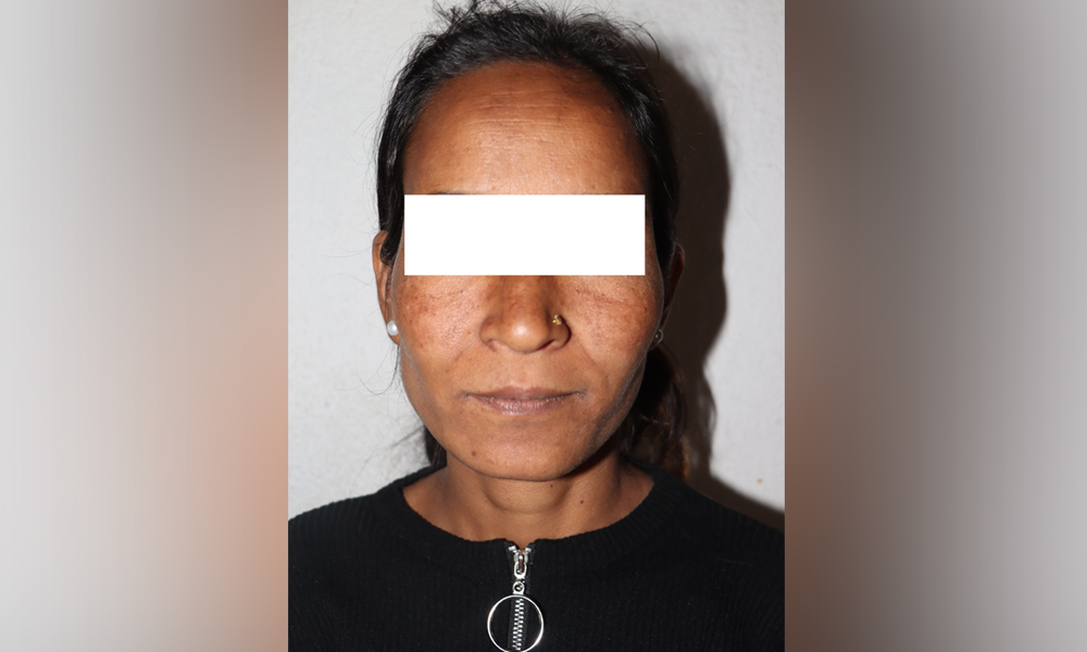 अछाममा भएको युवकको हत्यामा काठमाडौंबाट महिला पक्राउ