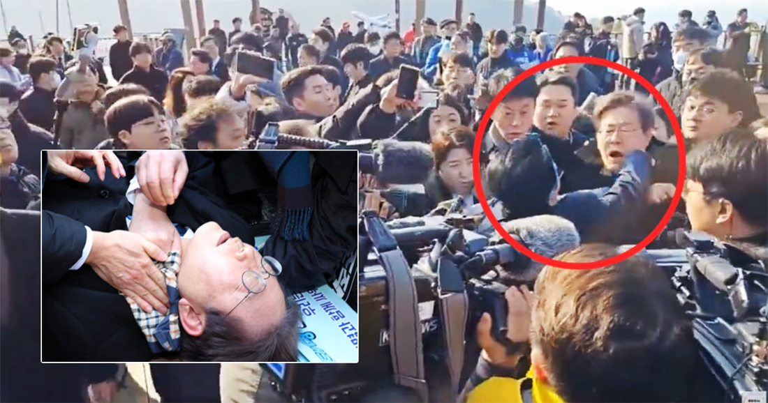 छुरा प्रहारबाट घाइते दक्षिण कोरियाली नेताको घाँटीमा डेढ सेन्टिमिटर गहिरो चोट